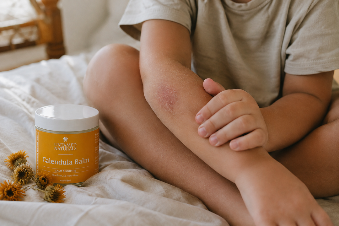 child holding dry patch that won't go away.